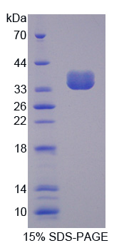 Recombinant Valosin Containing Protein (VCP)