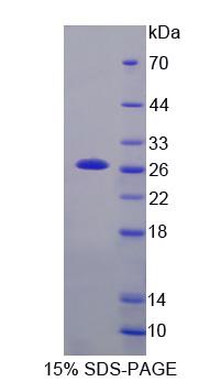 Recombinant X-linked Inhibitor Of Apoptosis Protein (XIAP)