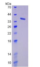 Recombinant Induced Myeloid Leukemia Cell Differentiation Protein Mcl-1 (MCL1)