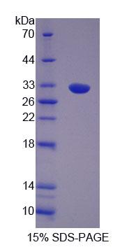 Recombinant Osteosarcoma Amplified 9 (OS9)