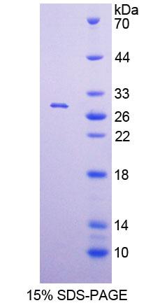 Recombinant Polymerase DNA Directed Alpha 1 (POLa1)