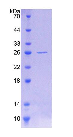 Recombinant Protein O-Mannosyltransferase 1 (POMT1)