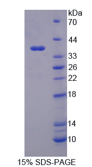 Recombinant Synapsin I (SYN1)