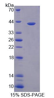Recombinant Poly ADP Ribose Polymerase 4 (PARP4)