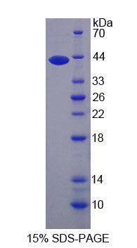 Recombinant Asparaginyl tRNA Synthetase (NARS)