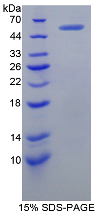 Recombinant X-Ray Repair Cross Complementing 5 (XRCC5)