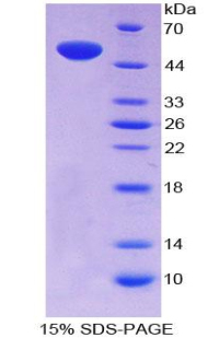 Recombinant Natriuretic Peptide Receptor 3 (NPR3)