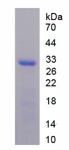 Recombinant Carbonic Anhydrase III, Muscle Specific (CA3)
