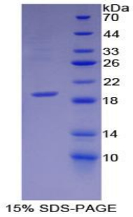 Recombinant Carbonic Anhydrase VI (CA6)