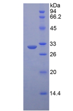 Recombinant Low Density Lipoprotein Receptor Related Protein 6 (LRP6)