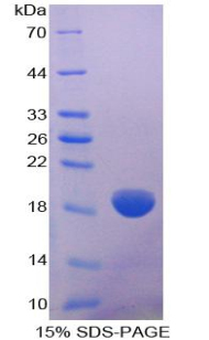 Recombinant Collagen Type VIII Alpha 2 (COL8a2)