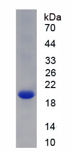 Recombinant Collagen Type VIII Alpha 2 (COL8a2)