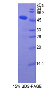 Recombinant Collagen Type XIV (COL14)