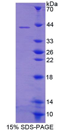 Recombinant S100 Calcium Binding Protein A14 (S100A14)