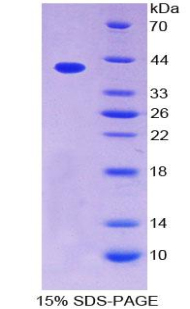 Recombinant Chemokine C-C-Motif Ligand 4 Like Protein 1 (CCL4L1)