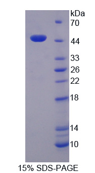 Recombinant Cytochrome P450 Reductase (CPR)