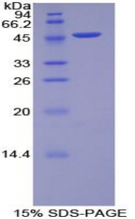 Recombinant Myosin Light Chain 6B, Alkali, Smooth Muscle And Non Muscle (MYL6B)