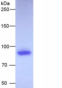 Recombinant Heat Shock Protein 90kDa Alpha B1 (HSP90aB1)
