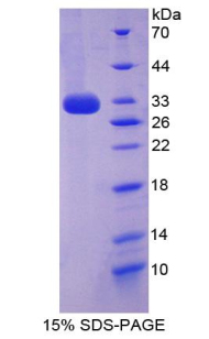Recombinant Cytochrome P450 27B1 (CYP27B1)