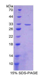 Recombinant Cytochrome P450 27B1 (CYP27B1)