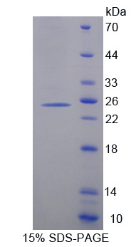 Recombinant Cytochrome P450 26A1 (CYP26A1)