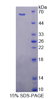 Recombinant Cytochrome P450 11B1 (CYP11B1)