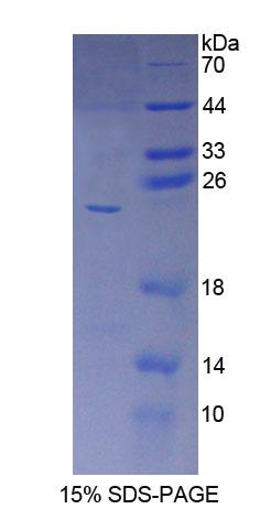 Recombinant Cytochrome P450 5A1 (CYP5A1)