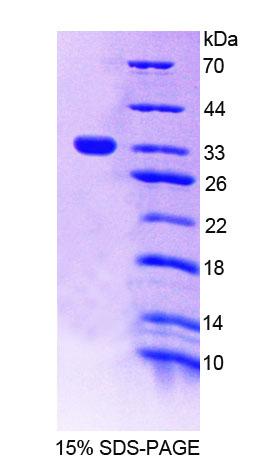 Recombinant Protein Tyrosine Phosphatase, Non Receptor Type 22 (PTPN22)