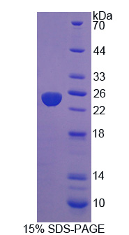 Recombinant Protein Tyrosine Phosphatase Type IVA 3 (PTP4A3)