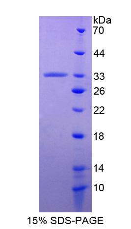 Recombinant Apolipoprotein A1 Binding Protein (APOA1BP)