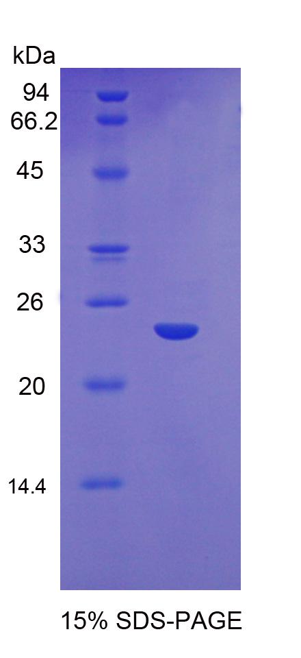 Recombinant Glutathione Synthetase (GSS)