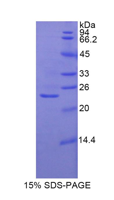 Recombinant Glutathione Synthetase (GSS)