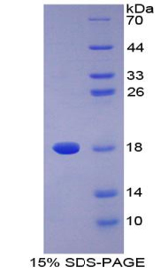 Recombinant Phospholipase A2, Group IIA (PLA2G2A)