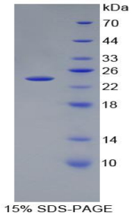 Recombinant Peptidoglycan Recognition Protein 1 (PGLYRP1)
