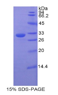 Recombinant Electron Transfer Flavoprotein Alpha Polypeptide (ETFa)
