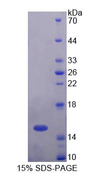 Recombinant Ubiquitin Associated Protein 2 (UBAP2)