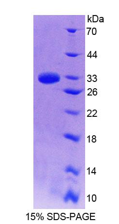 Recombinant Guanylate Binding Protein 7 (GBP7)