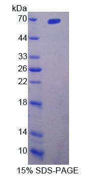 Recombinant Interleukin 23 Receptor (IL23R)