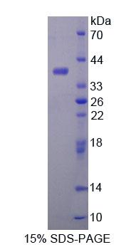 Recombinant Aldehyde Dehydrogenase 1 Family, Member A1 (ALDH1A1)