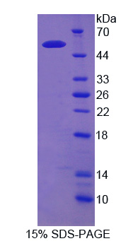 Recombinant Erythrocyte Membrane Protein Band 4.2 (EPB42)