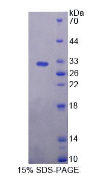 Recombinant Bcl2 Associated Athanogene 5 (BAG5)