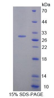Recombinant Bcl2 Associated Athanogene 5 (BAG5)
