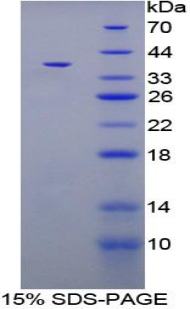 Recombinant Carboxypeptidase B1, Tissue (CPB1)
