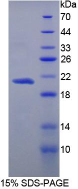 Recombinant Carboxypeptidase N1 (CPN1)