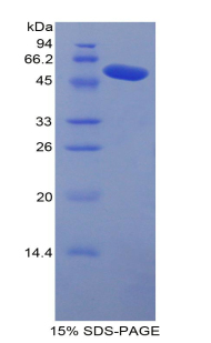 Recombinant Carboxypeptidase N1 (CPN1)