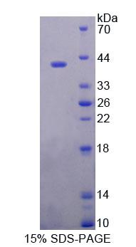 Recombinant Endoplasmic Reticulum Protein 44 (ERP44)