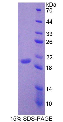 Recombinant Leukocyte Cell Derived Chemotaxin 2 (LECT2)