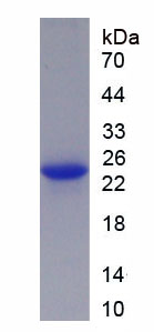 Recombinant Microfibrillar Associated Protein 5 (MFAP5)