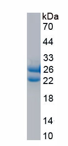 Recombinant Polymerase DNA Directed Gamma 1 (POLg1)