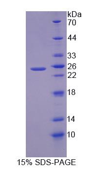 Recombinant Transient Receptor Potential Cation Channel Subfamily C, Member 6 (TRPC6)